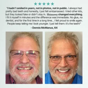 🦷Ends Today: 70% OFF! Shinneey®™ Custom-Fit Full Functional Dentures Make you more confident