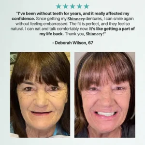 🦷Ends Today: 70% OFF! Shinneey®™ Custom-Fit Full Functional Dentures Make you more confident